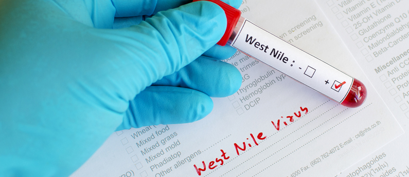 West Nile Virus: What you need to know