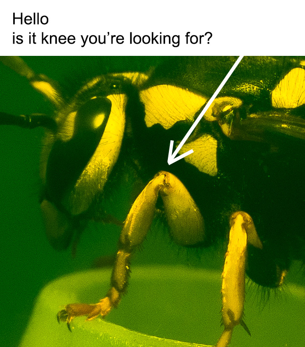 Hello Is it Knee You're Looking For